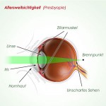 Ein gesundes Auge kann dank seiner Anpassungsfähigkeit (Akkommodation) sowohl weit entfernte Dinge scharf sehen als auch solche, die in dem Nahbereich liegen. 