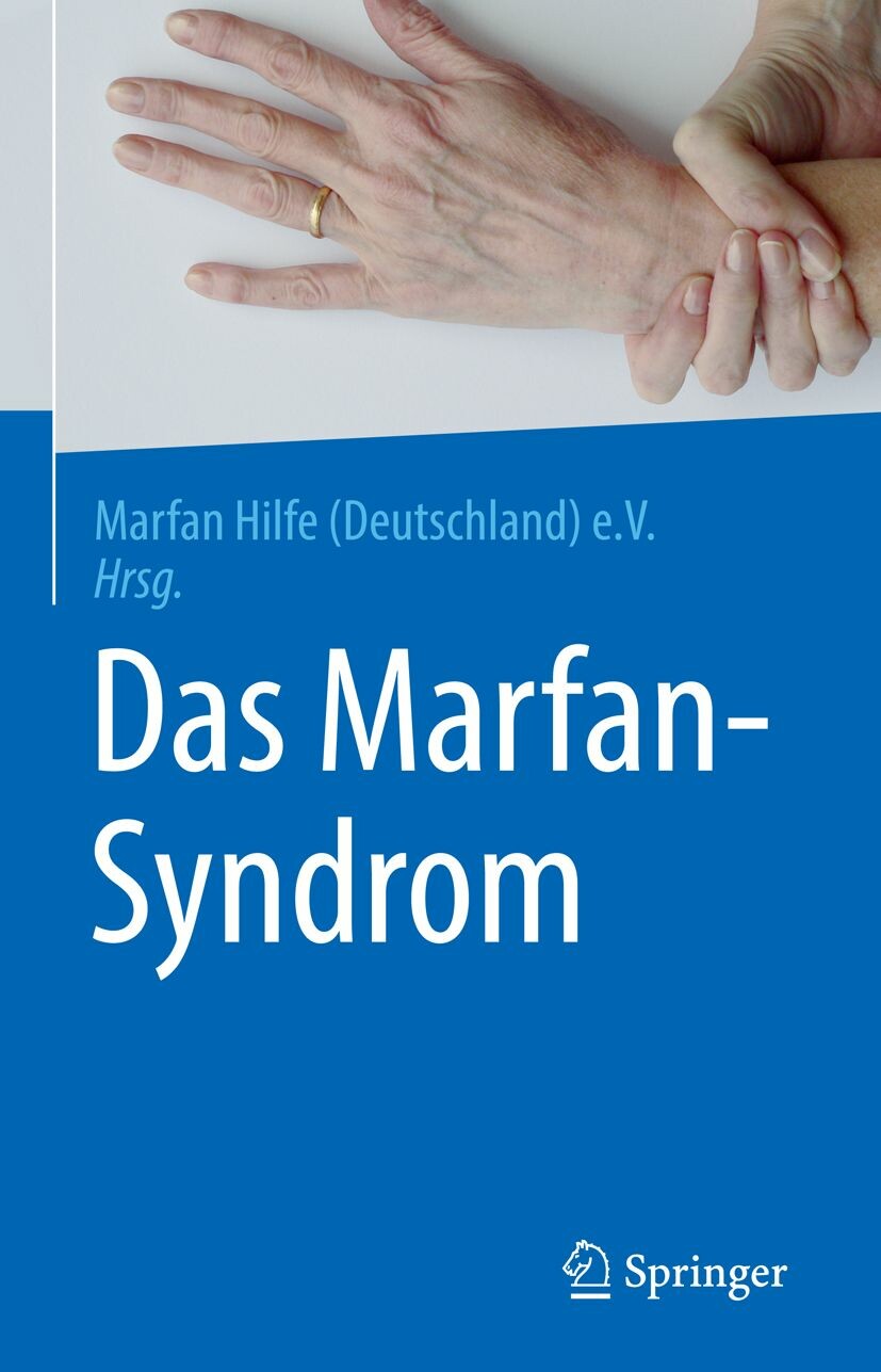 Das Marfan Syndrom Pdf Ebook Kaufen Ebooks Augenheilkunde Ophthalmologie